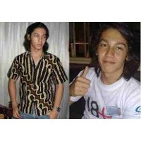 Wajah Samuel Zylgwyn Lumpuh Sebelah Karena Bells Palsy Wajah Samuel Zylgwyn Lumpuh Sebelah Karena Bells Palsy