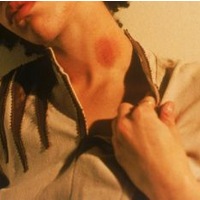 Cupang di Leher yang Bikin Stroke Cupang di Leher yang Bikin Stroke