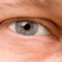 Bisakah Penglihatan Normal Lagi Setelah Retina Berlubang? Bisakah Penglihatan Normal Lagi Setelah Retina Berlubang?