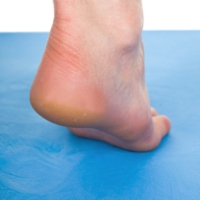 Kedua Tumit Kaki Sakit, Apakah Itu Penyakit Sesuatu? Kedua Tumit Kaki Sakit, Apakah Itu Penyakit Sesuatu?