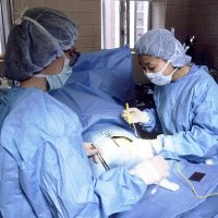Berapa Lama Penyembuhan Operasi Usus Buntu? Berapa Lama Penyembuhan Operasi Usus Buntu?