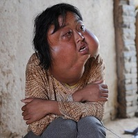 Saya Hanya Sakit, Bukan Monster Saya Hanya Sakit, Bukan Monster