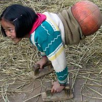 Gadis Bola Basket, Jalan Pakai Bola Basket Karena Tak Punya Kaki Gadis Bola Basket, Jalan Pakai Bola Basket Karena Tak Punya Kaki