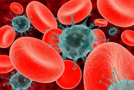 Pengobatan Apakah yang Terbaik untuk Kanker Multiple Myeloma? Pengobatan Apakah yang Terbaik untuk Kanker Multiple Myeloma?