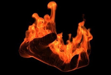 Pertolongan Pertama pada Luka Bakar Parah Pertolongan Pertama pada Luka Bakar Parah