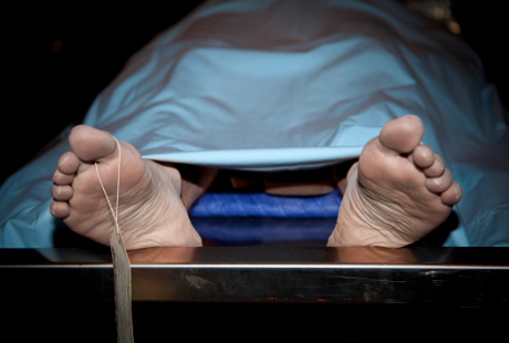 Bagaimana Pembuluh Darah Pecah Bisa Mengakibatkan Kematian? Bagaimana Pembuluh Darah Pecah Bisa Mengakibatkan Kematian?