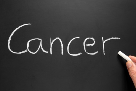 Saat Didiagnosa Kanker Datanglah ke Dokter, Bukan ke Dukun Saat Didiagnosa Kanker Datanglah ke Dokter, Bukan ke Dukun