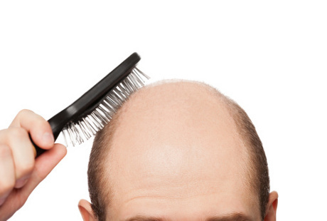Solusi Mengatasi Rambut Rontok Agar Lebih Percaya Diri Solusi Mengatasi Rambut Rontok Agar Lebih Percaya Diri