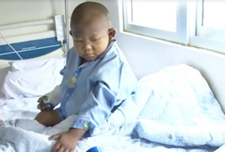 Ini Sebabnya Bocah Hafidz Meninggal Meski Sukses Transplantasi Hati Ini Sebabnya Bocah Hafidz Meninggal Meski Sukses Transplantasi Hati