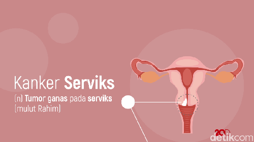 Ini Kisaran Biaya Vaksin HPV, Penangkal Kanker Serviks yang Mematikan Ini Kisaran Biaya Vaksin HPV, Penangkal Kanker Serviks yang Mematikan