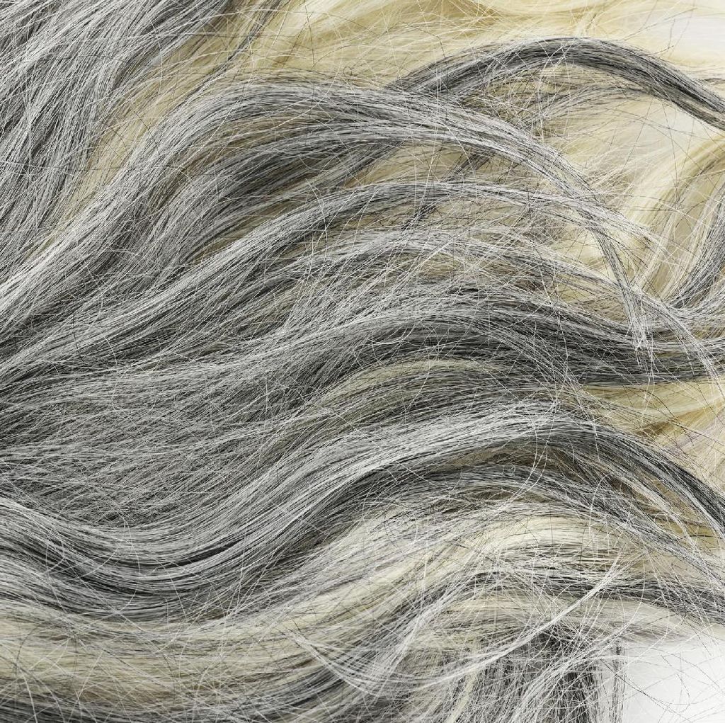 Aneh! Bukannya Rontok, Rambut Beruban Malah Jadi Hitam Akibat Terapi Kanker Aneh! Bukannya Rontok, Rambut Beruban Malah Jadi Hitam Akibat Terapi Kanker