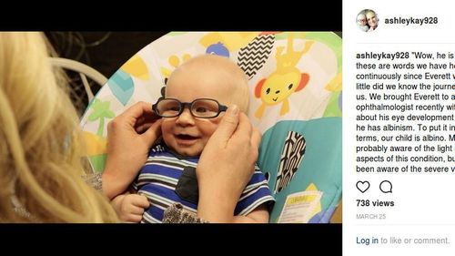 Ekspresi Bocah Albino dengan Penyakit Langka Saat Pertama Kali Bisa Lihat Ibunya Ekspresi Bocah Albino dengan Penyakit Langka Saat Pertama Kali Bisa Lihat Ibunya